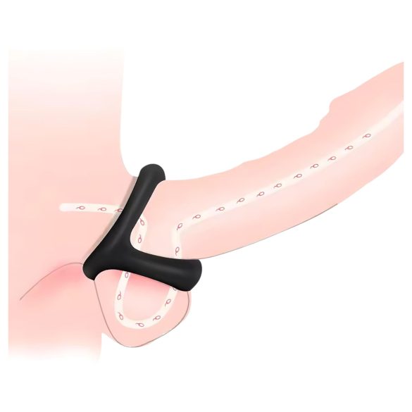 Pénisz- és heregyűrű pontozott felszínnel (fekete)